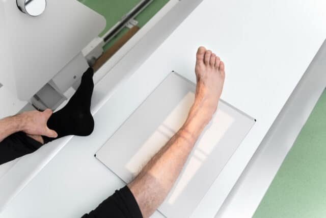 scanner IA détecte l'insuffisance cardiaque grâce aux pieds